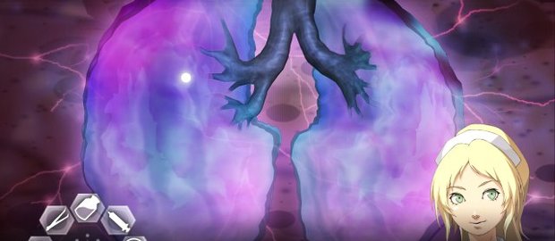 Trauma Center: Second Opinion News